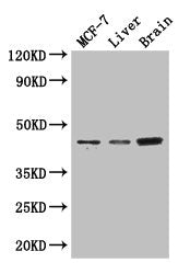 Western Blot Positive WB detected in: MCF-7 whole cell lysate, Mouse liver tissue, Mouse brain tissue All lanes: KCNJ11 antibody at 3µg/ml Secondary Goat polyclonal to rabbit IgG at 1/50000 dilution Predicted band size: 44, 34 kDa Observed band si...