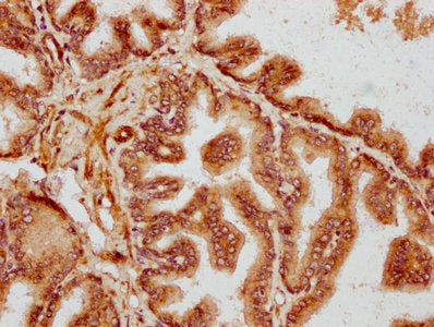 IHC image of CSB-PA622788LA01HU diluted at 1:300 and staining in paraffin-embedded human prostate tissue performed on a Leica BondTM system. After dewaxing and hydration, antigen retrieval was mediated by high pressure in a citrate buffer (pH 6.0)...