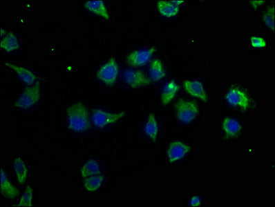 Immunofluorescence staining of Hela cells with CSB-PA622790LA01HU at 1:50, counter-stained with DAPI. The cells were fixed in 4% formaldehyde, permeabilized using 0.2% Triton X-100 and blocked in 10% normal Goat Serum. The cells were then incubate...