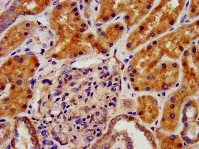IHC image of CSB-PA622791LA01HU diluted at 1:500 and staining in paraffin-embedded human kidney tissue performed on a Leica BondTM system. After dewaxing and hydration, antigen retrieval was mediated by high pressure in a citrate buffer (pH 6.0)....