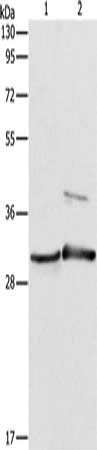 Gel: 10%SDS-PAGE, Lysate: 40 ug, Lane 1-2: Mouse muscle tissue, Mouse skin tissue, Primary antibody: CSB-PA622808(APOBEC2 Antibody) at dilution 1/450, Secondary antibody: Goat anti rabbit IgG at 1/8000 dilution, Exposure time: 10 seconds