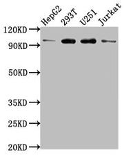 Western Blot Positive WB detected in: HepG2 whole cell lysate, 293T whole cell lysate, U251 whole cell lysate, Jurkat whole cell lysate All lanes: KPNB1 antibody at 1:2000 Secondary Goat polyclonal to rabbit IgG at 1/50000 dilution Predicted band...