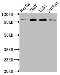 Western Blot Positive WB detected in: HepG2 whole cell lysate, 293T whole cell lysate, U251 whole cell lysate, Jurkat whole cell lysate All lanes: KPNB1 antibody at 1:2000 Secondary Goat polyclonal to rabbit IgG at 1/50000 dilution Predicted band...