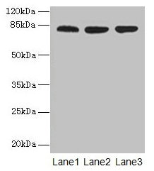 Western blot All lanes: ACAP1 antibody at 4µg/ml Lane 1: Mouse lung tissue Lane 2: Jurkat whole cell lysate Lane 3: K562 whole cell lysate Secondary Goat polyclonal to rabbit IgG at 1/10000 dilution Predicted band size: 82 kDa Observed band size:...