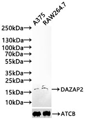 Western Blot Positive WB detected in: Hela whole cell lysate, A375 whole cell lysate, MCF-7 whole cell lysate, A549 whole cell lysate, SH-SY5Y whole cell lysate, Rat brain tissue All lanes: DAZAP2 antibody at 3.5µg/ml Secondary Goat polyclonal to...