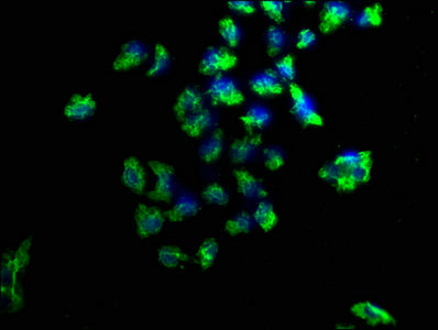 Immunofluorescence staining of Hela cells with CSB-PA622989LA01HU at 1:100, counter-stained with DAPI. The cells were fixed in 4% formaldehyde, permeabilized using 0.2% Triton X-100 and blocked in 10% normal Goat Serum. The cells were then incubat...