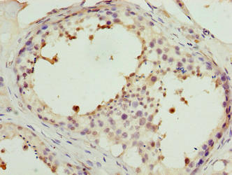 Immunohistochemistry of paraffin-embedded human testis tissue using CSB-PA622999LA01HU at dilution of 1:100
