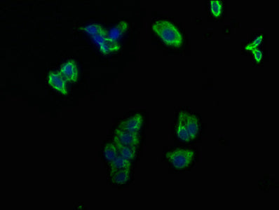 Immunofluorescence staining of HepG2 cells with CSB-PA623000LA01HU at 1:100, counter-stained with DAPI. The cells were fixed in 4% formaldehyde, permeabilized using 0.2% Triton X-100 and blocked in 10% normal Goat Serum. The cells were then incuba...