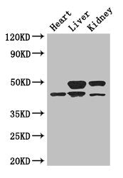 Western Blot Positive WB detected in: Mouse heart tissue, Mouse liver tissue, Mouse kidney tissue All lanes: TGIF1 antibody at 3ug/ml Secondary Goat polyclonal to rabbit IgG at 1/50000 dilution Predicted band size: 44, 30, 32, 28 kDa Observed band...