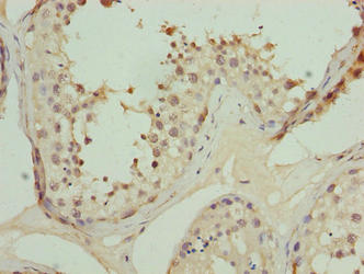 Immunohistochemistry of paraffin-embedded human testis tissue using CSB-PA623008LA01HU at dilution of 1:100