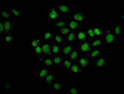 Immunofluorescence staining of Hela cells with CSB-PA623010LA01HU at 1:133, counter-stained with DAPI. The cells were fixed in 4% formaldehyde, permeabilized using 0.2% Triton X-100 and blocked in 10% normal Goat Serum. The cells were then incubat...