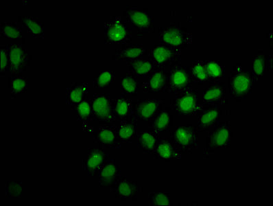 Immunofluorescence staining of Hela cells with CSB-PA623010LA01HU at 1:133, counter-stained with DAPI. The cells were fixed in 4% formaldehyde, permeabilized using 0.2% Triton X-100 and blocked in 10% normal Goat Serum. The cells were then incubat...