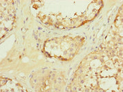 Immunohistochemistry of paraffin-embedded human testis tissue using CSB-PA623014DSR1HU at dilution of 1:100