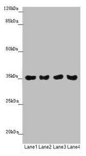 Western blot All lanes: TOMM34 antibody at 1.42µg/ml Lane 1: Mouse gonadal tissue Lane 2: A549 whole cell lysate Lane 3: PC-3 whole cell lysate Lane 4: A375 whole cell lysate Secondary Goat polyclonal to rabbit IgG at 1/10000 dilution Predicted ba...