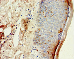 Immunohistochemistry of paraffin-embedded human skin tissue using CSB-PA623015ESR2HU at dilution of 1:100