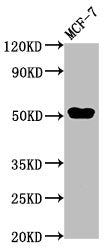 Western Blot Positive WB detected in: MCF-7 whole cell lysate All lanes: CCDC6 antibody at 3µg/ml Secondary Goat polyclonal to rabbit IgG at 1/50000 dilution Predicted band size: 54 kDa Observed band size: 54 kDa