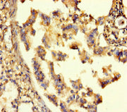 Immunohistochemistry of paraffin-embedded human lung tissue using CSB-PA623078LA01HU at dilution of 1:100
