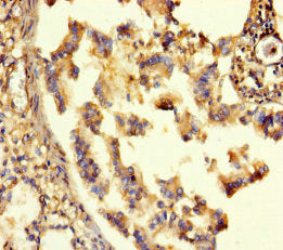 Immunohistochemistry of paraffin-embedded human lung tissue using CSB-PA623078LA01HU at dilution of 1:100