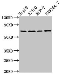 Western Blot Positive WB detected in: HepG2 whole cell lysate, A2780 whole cell lysate, MCF-7 whole cell lysate, RAW264.7 whole cell lysate All lanes: PRSS8 antibody at 2µg/ml Secondary Goat polyclonal to rabbit IgG at 1/50000 dilution Predicted b...
