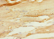 Immunohistochemistry of paraffin-embedded human skeletal muscle tissue using CSB-PA623099ESR2HU at dilution of 1:100