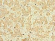 Immunohistochemistry of paraffin-embedded human liver tissue using CSB-PA623168LA01HU at dilution of 1:100