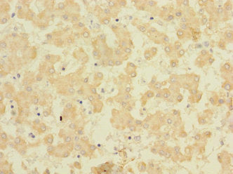 Immunohistochemistry of paraffin-embedded human liver tissue using CSB-PA623168LA01HU at dilution of 1:100