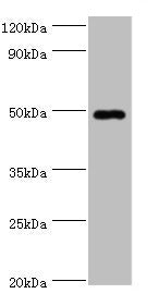 Western blot All lanes: HYAL1 antibody at 2µg/ml + HepG2 whole cell lysate Secondary Goat polyclonal to rabbit IgG at 1/10000 dilution Predicted band size: 49, 46, 28, 24, 20, 11, 38 kDa Observed band size: 49 kDa