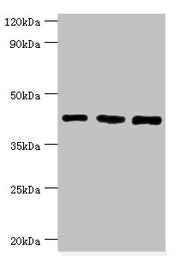 Western blot All lanes: SWI/SNF-related matrix-associated actin-dependent regulator of chromatin subfamily B member 1 antibody at 8ug/ml Lane 1: Hela whole cell lysate Lane 2: 293T whole cell lysate Lane 3: Mouse stomach tissue Secondary Goat poly...