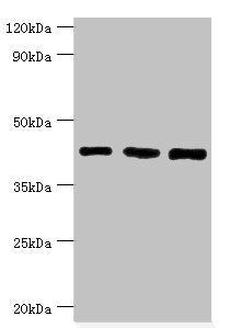 Western blot All lanes: SWI/SNF-related matrix-associated actin-dependent regulator of chromatin subfamily B member 1 antibody at 8ug/ml Lane 1: Hela whole cell lysate Lane 2: 293T whole cell lysate Lane 3: Mouse stomach tissue Secondary Goat poly...