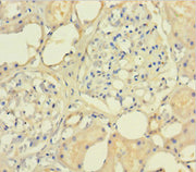 Immunohistochemistry of paraffin-embedded human kidney tissue using CSB-PA623654LA01HU at dilution of 1:100