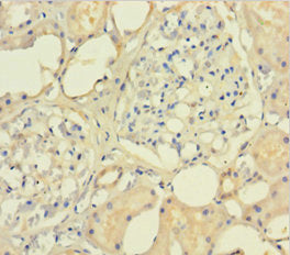 Immunohistochemistry of paraffin-embedded human kidney tissue using CSB-PA623654LA01HU at dilution of 1:100