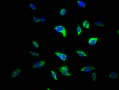 Immunofluorescence staining of U251 cells with CSB-PA623656LA01HU at 1:133, counter-stained with DAPI. The cells were fixed in 4% formaldehyde, permeabilized using 0.2% Triton X-100 and blocked in 10% normal Goat Serum. The cells were then incubat...
