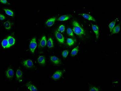 Immunofluorescence staining of A549 cells with CSB-PA623657LA01HU at 1:66, counter-stained with DAPI. The cells were fixed in 4% formaldehyde, permeabilized using 0.2% Triton X-100 and blocked in 10% normal Goat Serum. The cells were then incubate...