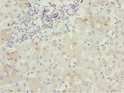 Immunohistochemistry of paraffin-embedded human liver tissue using CSB-PA623663ESR1HU at dilution of 1:100