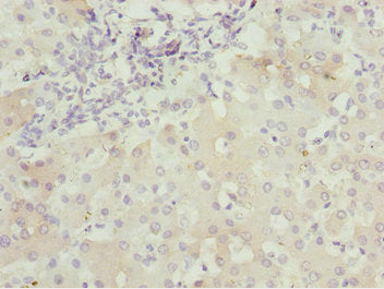 Immunohistochemistry of paraffin-embedded human liver tissue using CSB-PA623663ESR1HU at dilution of 1:100