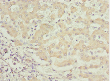 Immunohistochemistry of paraffin-embedded human liver tissue using CSB-PA623663ESR2HU at dilution of 1:100