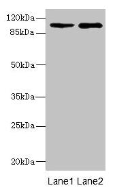 Western blot All lanes: GRIK3 antibody at 1.45µg/ml Lane 1: Hela whole cell lysate Lane 2: K562 whole cell lysate Secondary Goat polyclonal to rabbit IgG at 1/10000 dilution Predicted band size: 105, 99 kDa Observed band size: 105 kDa