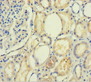 Immunohistochemistry of paraffin-embedded human kidney tissue using CSB-PA623780LA01HU at dilution of 1:100