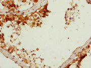 Immunohistochemistry of paraffin-embedded human testis tissue using CSB-PA623785ESR1HU at dilution of 1:100