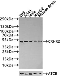 Western Blot Positive WB detected in: Mouse Brain tissue lysate(20µg),Mouse skeletal muscle tissue lysate(20µg),Rat skeletal muscle tissue lysate(20µg),293 whole cell lysate(20µg), A549 whole cell lysate(20µg) All lanes: CRHR2 antibody at 1:1000 S...