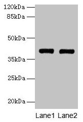 Western blot All lanes: MAB21L1 antibody at 6µg/ml Lane 1: A375 whole cell lysate Lane 2: CEM whole cell lysate Secondary Goat polyclonal to rabbit IgG at 1/10000 dilution Predicted band size: 41 kDa Observed band size: 41 kDa