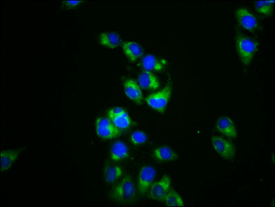Immunofluorescence staining of Hela cells with CSB-PA623806LA01HU at 1:133, counter-stained with DAPI. The cells were fixed in 4% formaldehyde, permeabilized using 0.2% Triton X-100 and blocked in 10% normal Goat Serum. The cells were then incubat...
