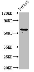 Western Blot Positive WB detected in: Jurkat whole cell lysate All lanes: IL18R1 antibody at 2µg/ml Secondary Goat polyclonal to rabbit IgG at 1/50000 dilution Predicted band size: 63 kDa Observed band size: 63 kDa