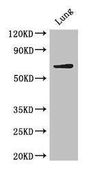 Western Blot Positive WB detected in: Mouse lung tissue All lanes: BIRC3 antibody at 4ug/ml Secondary Goat polyclonal to rabbit IgG at 1/50000 dilution Predicted band size: 69 kDa Observed band size: 69 kDa