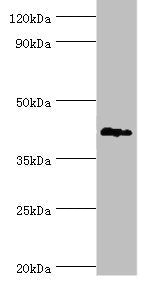 Western blot All lanes: G/T mismatch-specific thymine DNA glycosylase antibody at 6ug/ml + Mouse brain tissue Secondary Goat polyclonal to rabbit IgG at 1/10000 dilution Predicted band size: 46 kDa Observed band size: 46 kDa