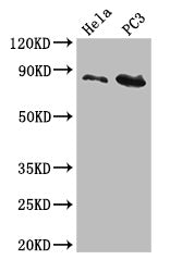 Western Blot Positive WB detected in: Hela whole cell lysate, PC-3 whole cell lysate All lanes: CUL2 antibody at 5µg/ml Secondary Goat polyclonal to rabbit IgG at 1/50000 dilution Predicted band size: 87, 90 kDa Observed band size: 87 kDa