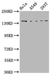 Western Blot Positive WB detected in: Hela whole cell lysate, A549 whole cell lysate, 293T whole cell lysate All lanes: CNGB1 antibody at 4.6µg/ml Secondary Goat polyclonal to rabbit IgG at 1/50000 dilution Predicted band size: 140, 71, 33 kDa Obs...