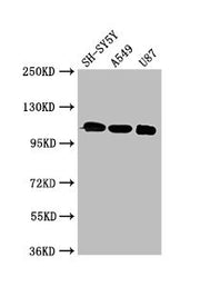 Western Blot Positive WB detected in: SH-SY5Y whole cell lysate, A549 whole cell lysate, U87 whole cell lysate All lanes: LRP8 antibody at 3µg/ml Secondary Goat polyclonal to rabbit IgG at 1/50000 dilution Predicted band size: 106, 78, 100, 88 kDa...