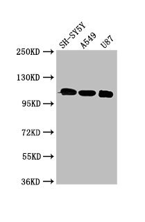 Western Blot Positive WB detected in: SH-SY5Y whole cell lysate, A549 whole cell lysate, U87 whole cell lysate All lanes: LRP8 antibody at 3µg/ml Secondary Goat polyclonal to rabbit IgG at 1/50000 dilution Predicted band size: 106, 78, 100, 88 kDa...