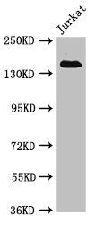 Western Blot Positive WB detected in: Jurkat whole cell lysate All lanes: EIF3A antibody at 4µg/ml Secondary Goat polyclonal to rabbit IgG at 1/50000 dilution Predicted band size: 167, 163 kDa Observed band size: 167 kDa